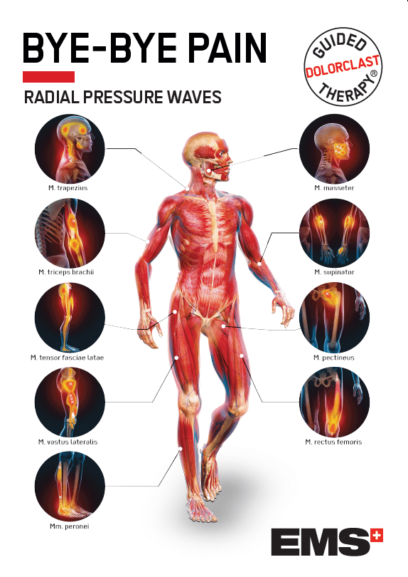 Shockwave Dissection Shockwave Therapy in Brooklyn | Plantar Fasciitis, Tennis Elbow